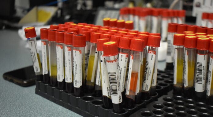 Coopesalud alerta que fechas festivas no deben de ser motivo para descuidar la salud